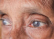 detail shot of asian senior women eye