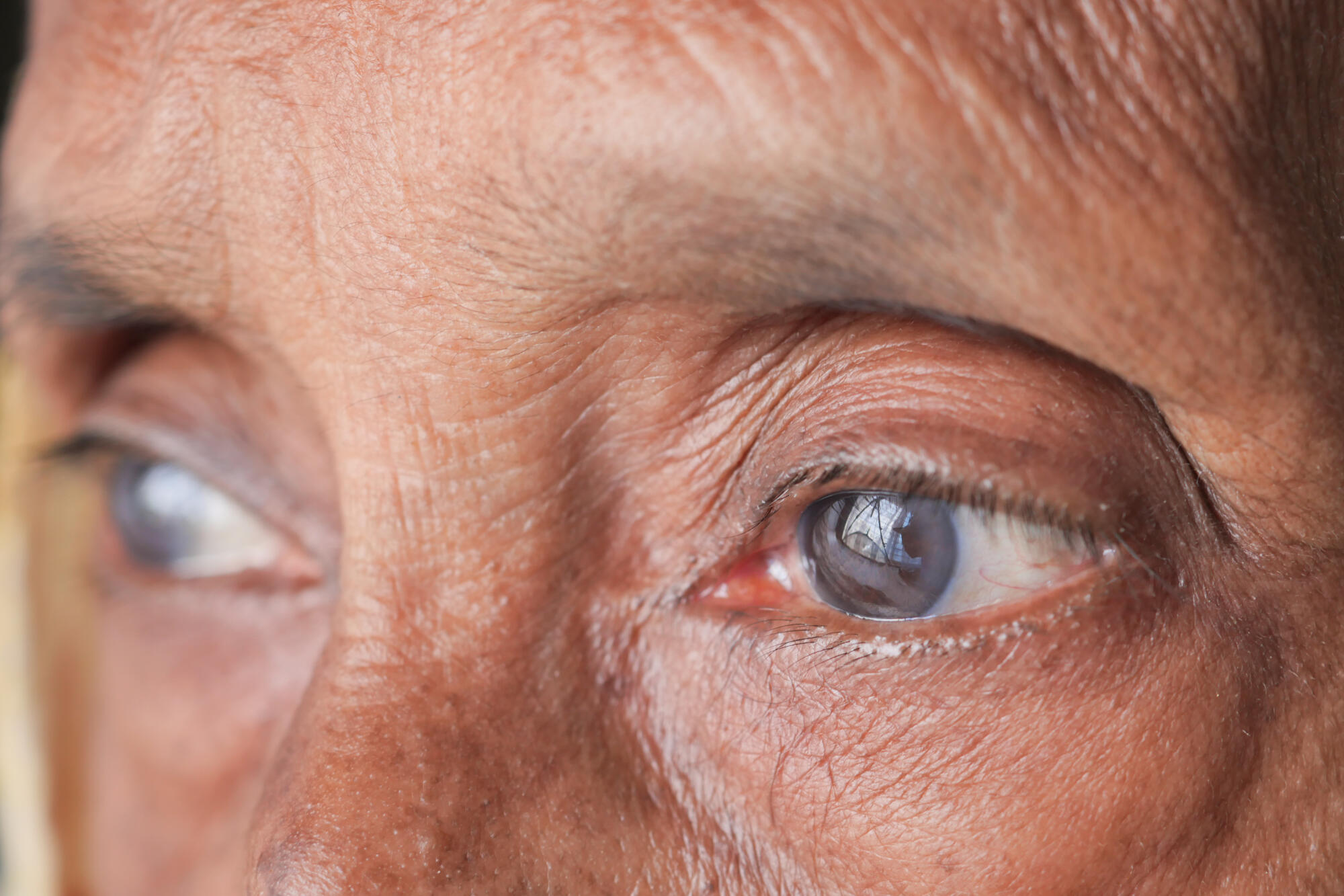 detail shot of asian senior women eye detail shot of asian senior women eye